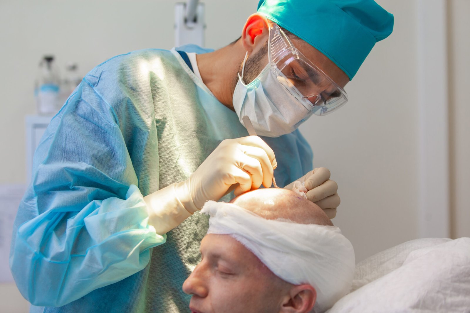 Baldness treatment. Hair transplant. Surgeons in the operating room carry out hair transplant surgery. Surgical technique that moves hair follicles from a part of the head